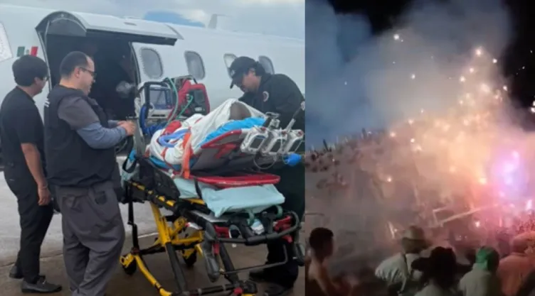 Estado de salud de la Ximena, niña con quemaduras tras explosión de pirotecnia en Temascalcingo, Edomex