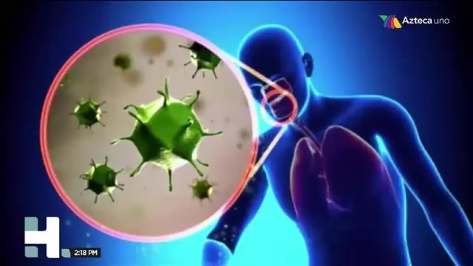 tuberculosis,-una-infeccion-bacteriana-dificil-de-combatir