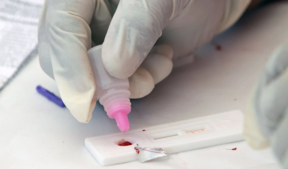 La Secretaría de Salud realizará el próximo 28 de noviembre, en 29 entidades del país, pruebas rápidas de detección de VIH