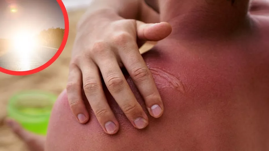 Mexicali bajo alerta por calor extremo y radiación UV alta