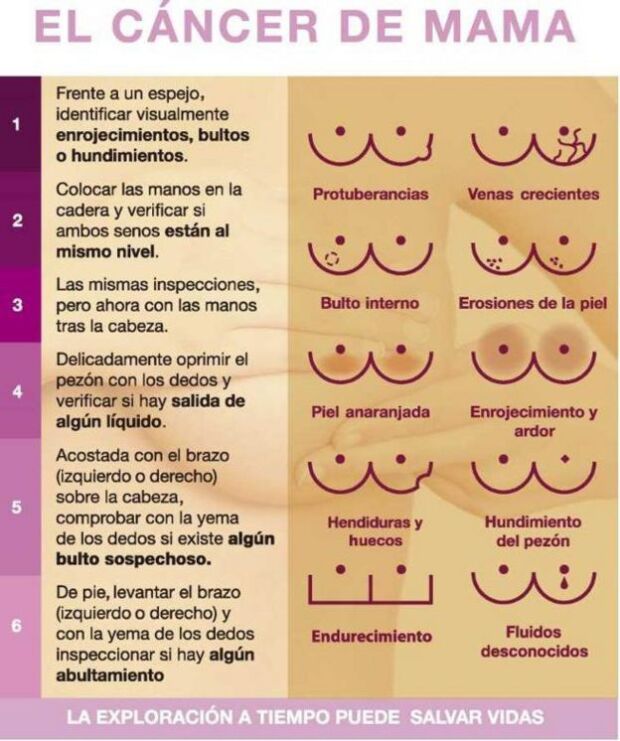 Cáncer de mama, síntomas A.jpg