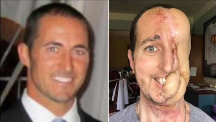 Caso Tim McGrath