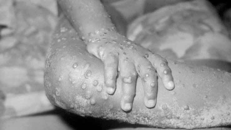 Credito: Twitter/@LuisLlanoMacedo/ - 1