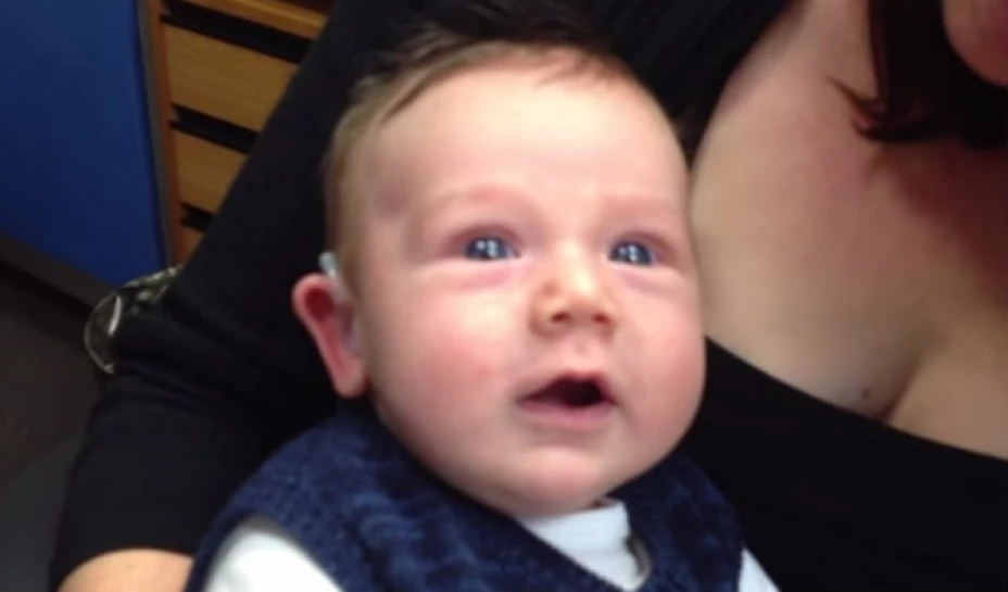 Un bebé australiano que nació con discapacidad auditiva expresa su emoción al escuchar, por primera vez, la voz de sus padres