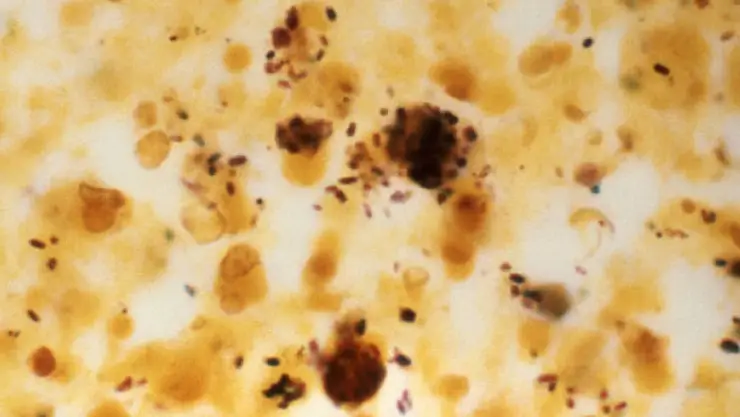 Legionella