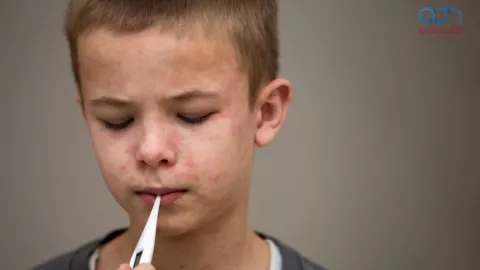 Especialista: Personas con sarampión podrían perder la audición