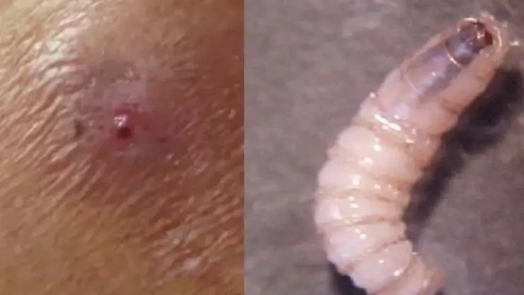 ¡Alerta! Confirman la primera MUERTE en Yucatán por GUSANO BARRENADOR en HUMANOS; esto se sabe