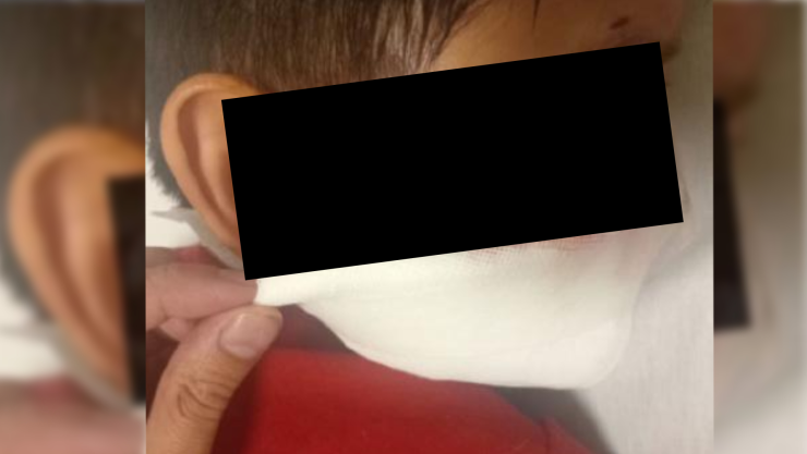 ataque perritos chihuahua.jpg