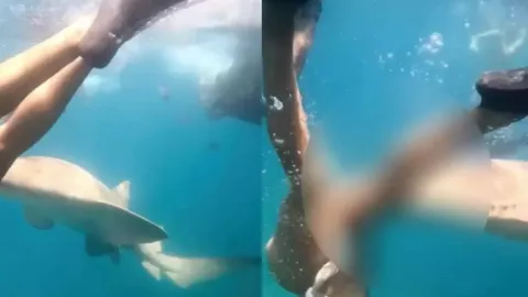 VIDEO | Tiburón muerde a una mujer que practicaba snorkel en playa de Brasil