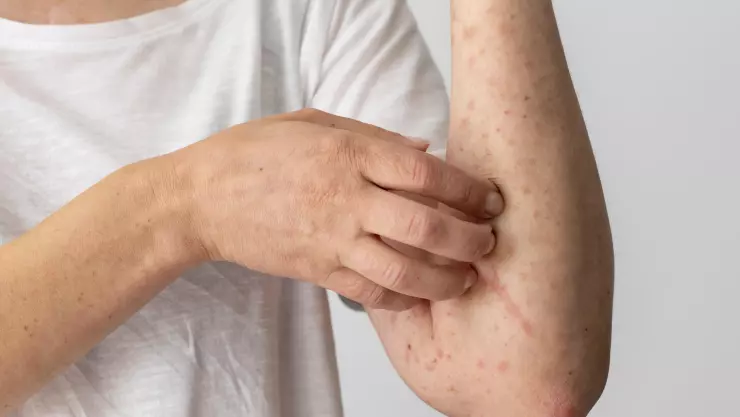 Enfermedades de la piel