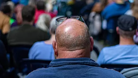 alopecia covid-19 .jpg