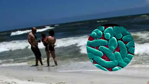 ¿Bacterias comecarne presentes en playas del Golfo de México