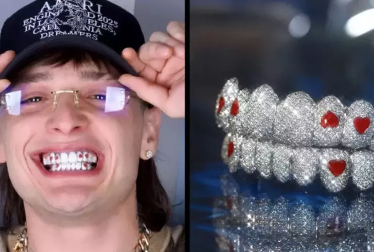 Peso pluma estrena dentadura de diamantes cuánto cuesta