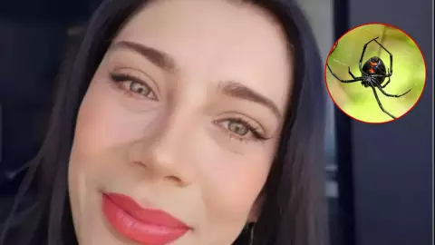 Hospitalizan de emergencia a Cynthia Klitbo tras picadura de araña viuda negra.