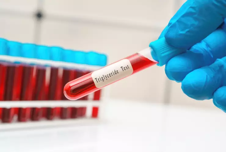 El plan de 7 comidas para bajar el colesterol y triglicéridos en una semana