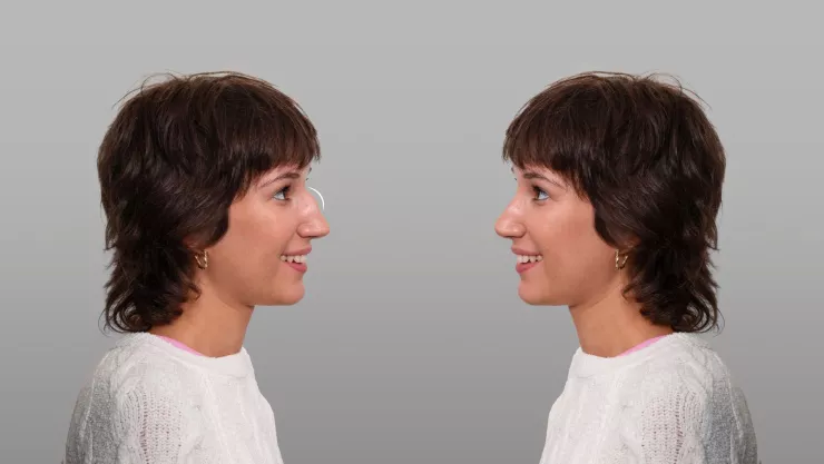 ¿Los has visto La inquietante teoría de las 7 personas parecidas a ti en el mundo.jpg