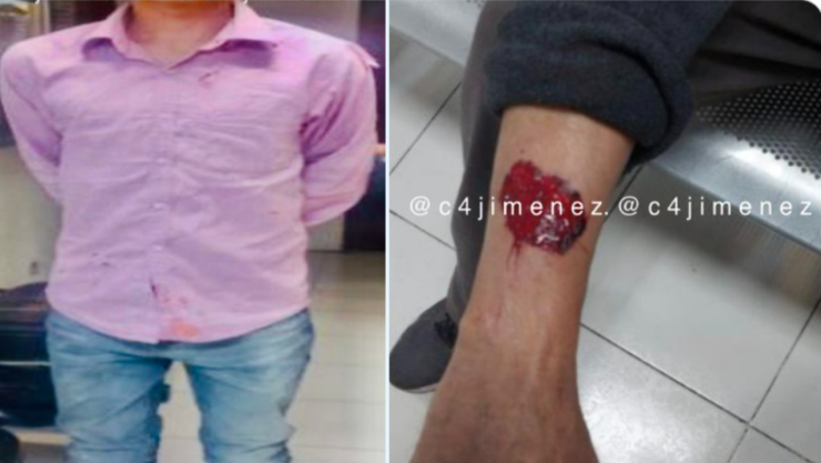 Joven alcoholizado muerde a su abuelo