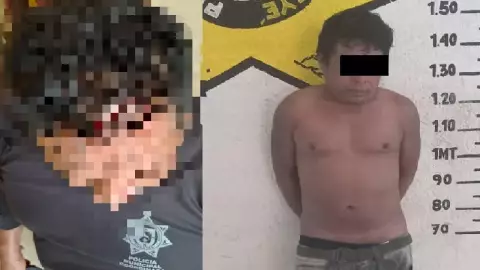 FOTO_ Hombre machetea a un policía en Seyé