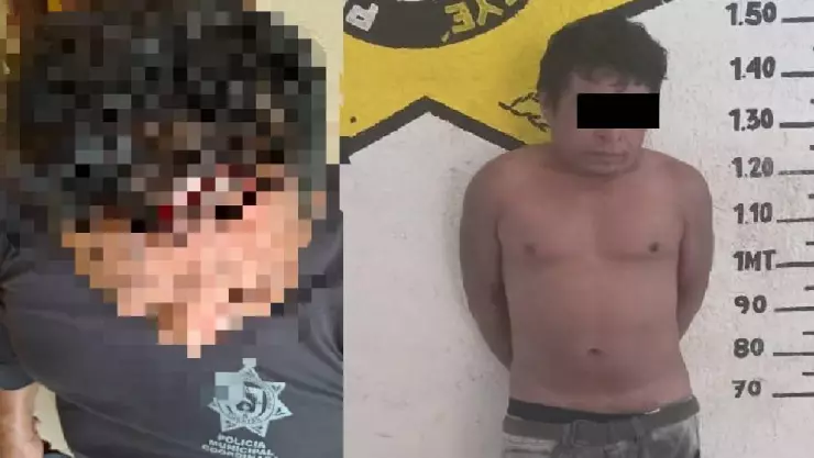 FOTO_ Hombre machetea a un policía en Seyé