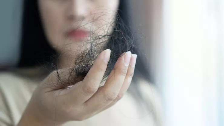 La edad exacta en que se le cae m&aacute;s el pelo a las mujeres, seg&uacute;n estudio