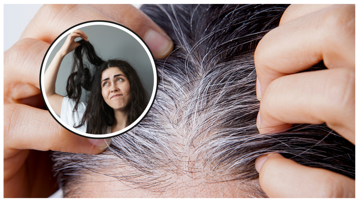 canas de joven