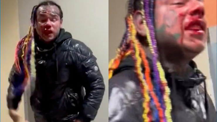 Video El rapero Tekashi 6ix9ine recibe brutal golpiza que lo llevó al hospital