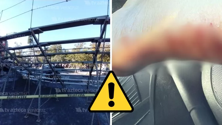 Imágenes compartidas en redes muestran las secuelas del accidente