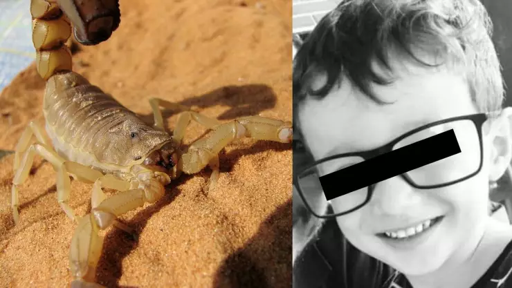 Niño de 7 años muere por picadura de escorpión.jpg