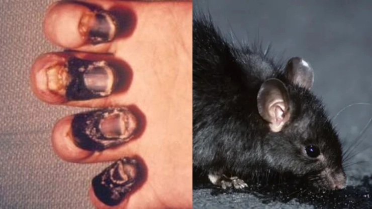 Aumento de casos de peste bubónica enciende las alarmas