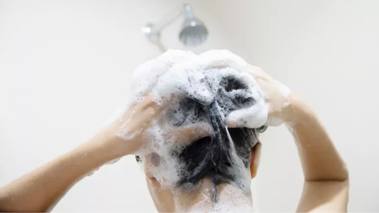 Joven pierde dedos tras usar shampoo contra piojos: su historia y advertencia