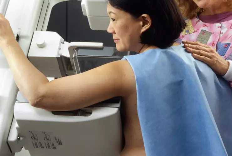 Día-Internacional-contra-el-cáncer-de-mama-Cuáles-son-los-tipos-de-mastografías-para-su-detección