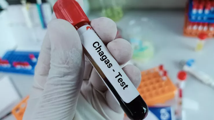 Enfermedad de Chagas