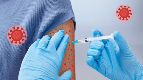 ¿Quiénes deben vacunarse contra el sarampión? La UNAM explica que mayores de 50 años no necesitan vacuna