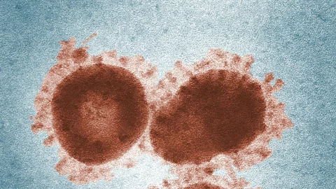metapneumovirus