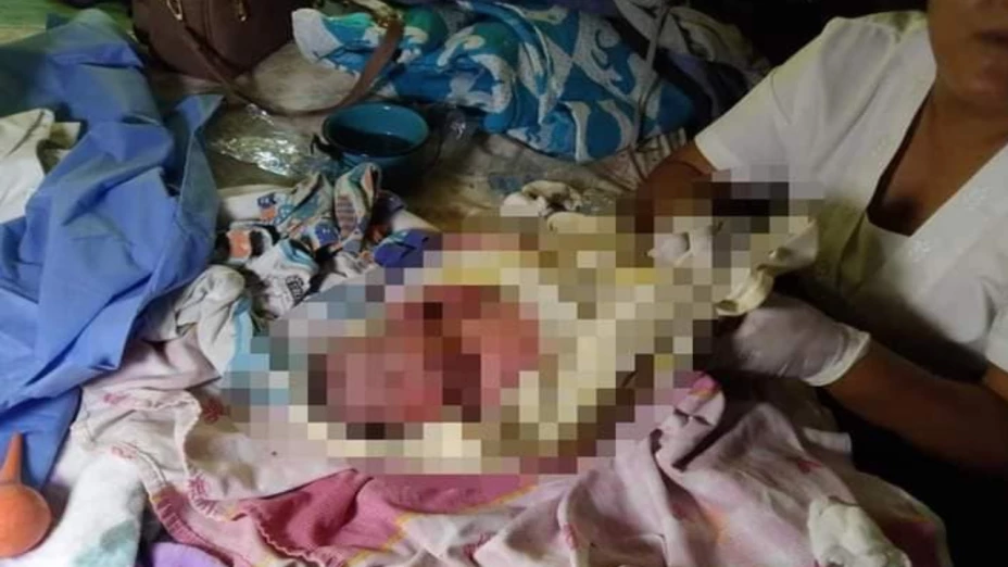 Bebé abandonado en Atoyac Veracruz