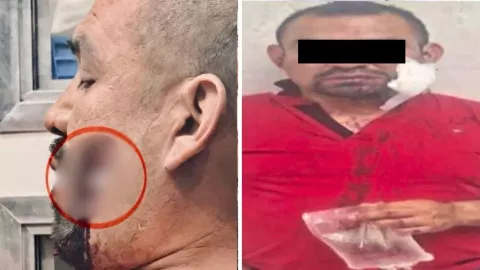 El detenido fue trasladado a un hospital bajo custodia policial