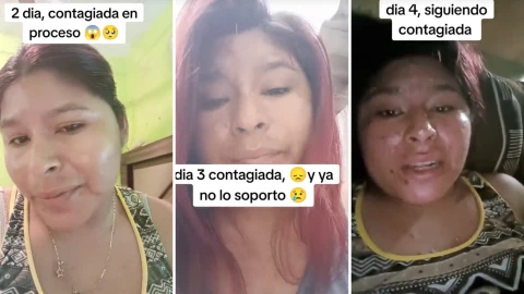 viral-joven-viruela-del-mono-narra-como-es-tener-enfermedad