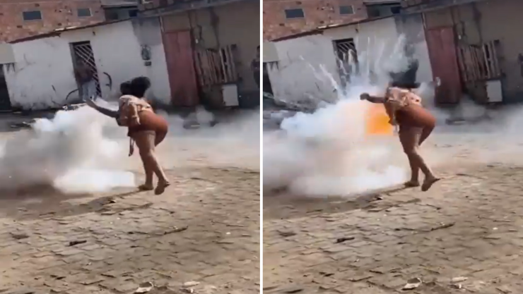 Le explota pirotecnia en la cara durante fiestas en Brasil; mujer sufre graves lesiones.png