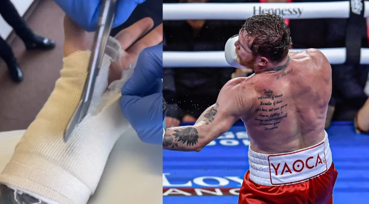 Canelo Álvarez operacion mano izquierda