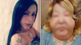 Influencer denuncia deformación tras recibir aceite y laxantes en clínica estética ilegal.png