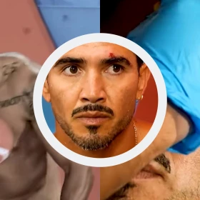 ¿Fue muy grave? Así fue el accidente que sufrió “El Mono” Osuna antes de entrar a La Granja VIP