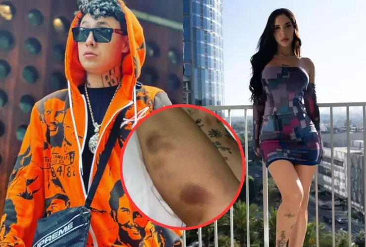 Alemán es denunciado por su novia Akasha de violencia física