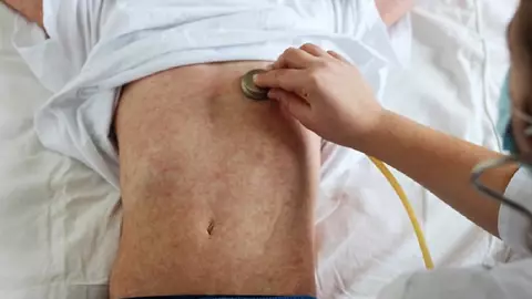 Casos de sarampión en Guerrero