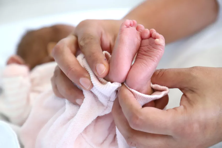 sindrome de Turner IMSS.jpg