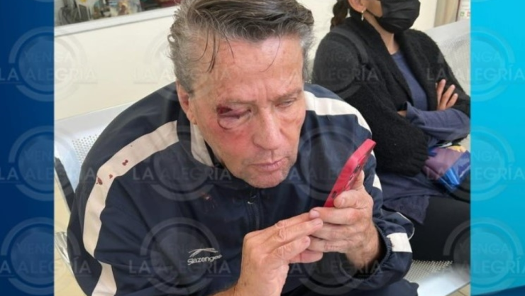 ALFREDO ADAME ES GOLPEADO