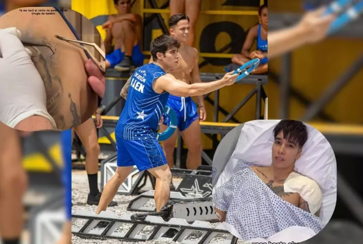 Alex Sotelo rompe el silencio y muestra cómo va sanando su cuerpo tras la dolorosa cirugía