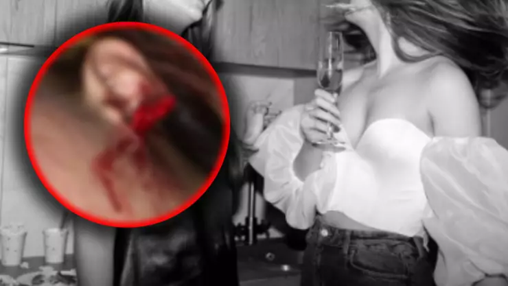 ¡A mordidas! Joven asegura que le arrancaron media oreja con una mordida y el caso se viraliza en redes sociales