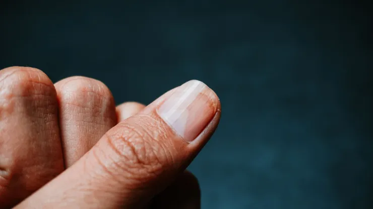 uñas