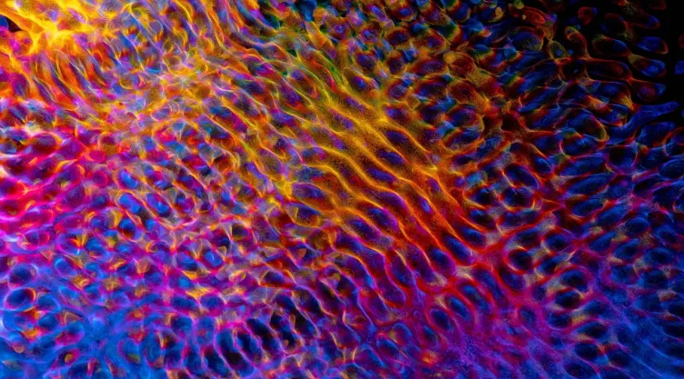 LSD y cerebro: qué efectos puede tener después del “viaje”