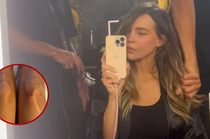 Belinda sorprende al compartir impactante FOTO de sus heridas por caída.jpg